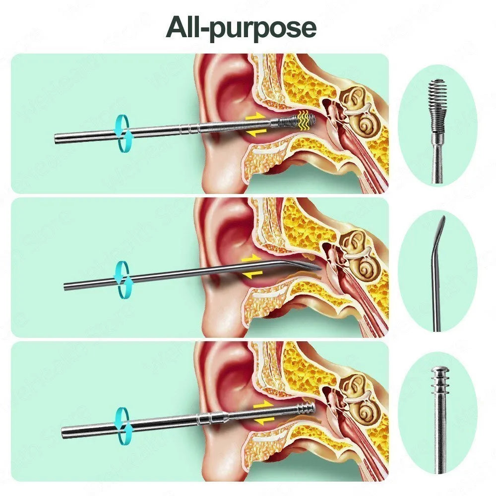 Ear Wax Remover